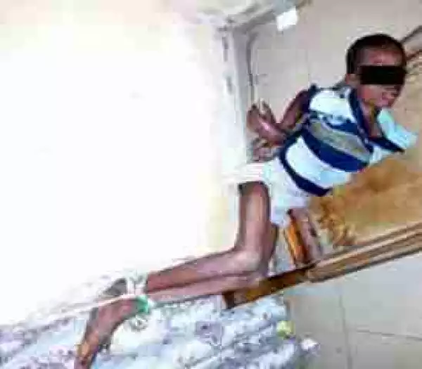 Father Burns 13-yr-old Son With Iron, Ties Him To Window For 3 Days, See Why He Did It [Disturbing Photos]